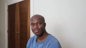 Losing one's hair can have a serious psychological impact for many. K S I Want To See Ksi Bald Be Sure To Get His Album To Number 1 And He Ll Do It Buy The Album Here Https Ksi Tmstor Es Cart Product Php Id 64510 Facebook