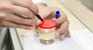Buang air kecil sudah adalah salah satu perkara yang wajib dilakukan oleh semua manusia. Why Urine Tests Are Routine During Pregnancy Babycenter