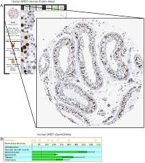 Access online via elsevier, 2006. The Bioinformatics Tool Box For Reproductive Biology Sciencedirect