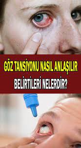 Goz Tansiyonu Ya Da Karasu Hastaligi Belirtileri Nelerdir Nasil Tedavi Edilir Tansiyon Saglik Formda Kal