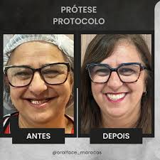 Dr. Ramon Vieira Netto (@dr.ramonvieira) • Instagram photos and videos