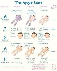 Image result for APGAR Score