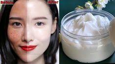 Remove BLACKHEADS WHITEHEADS CLOGED PORES Naturally