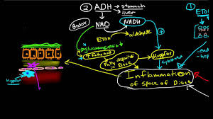 Pathophysiology Of Cirrhosis