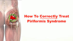 Muscles transfer force to bones through tendons. How To Correctly Treat Piriformis Syndrome Squat University