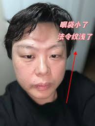 🌹🌹大家有沒有發現隨著年齡的增長，我們的臉開始變得越來越松，眼袋越來越大？法令紋越來越深……？  世界可能會塌，我們毫無辦法￼但至少，我們可以想辦法讓臉不要塌￼  無論是身體，還是面部的緊致，都是和我們的這個循環健康密切相關。雲朵機就是通過改善我們的淋巴循環 ...