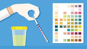 Ketones In Urine Test What It Measures And What Results