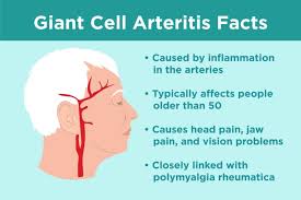 Pin By Anastasija Lakic On Fibromyalgia In 2020 Giant Cell Arteritis Polymyalgia Rheumatica Temporal Arteritis