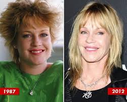 Melanie Griffith Plastic Surgery Disaster Before After Melanie Griffith Plastic Surgery Bad Plastic Surgeries Plastic Surgery