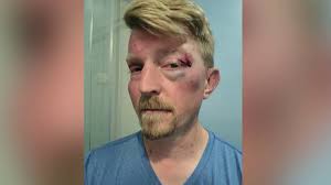 Good Samaritan Beaten After Breaking Up Domestic Assault