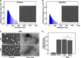 Check spelling or type a new query. Membrane Vesicles Nucleate Mineralo Organic Nanoparticles And Induce Carbonate Apatite Precipitation In Human Body Fluids Journal Of Biological Chemistry