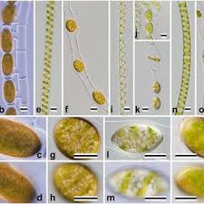 Check spelling or type a new query. Pdf Identification Of 13 Spirogyra Species Zygnemataceae By Traits Of Sexual Reproduction Induced Under Laboratory Culture Conditions
