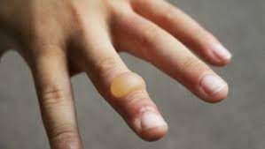 First Aid For Burns: Parent Faqs - Healthychildren.org
