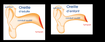 Il se retrouve avec le bout du coton tige coincé dans l'oreille. L Interet Du Lavage Des Oreilles