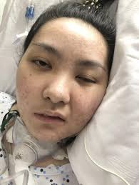 Andrew Schimmer Wife Si Jho Rovero Pumanaw Na