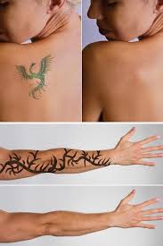 Many tattoo removal creams contain bleaching ingredients and/or harsh acids that claim to pull out that unwanted ink. Does Tattoo Removal Cream Work Tattooglee Tattoo Removal Cream Tattoo Removal Tattoos