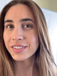 How I Embrace My Imperfections — DPR SKN