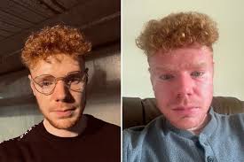 I thought I had food poisoning