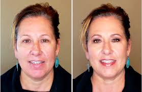 Winner is Katie ,from L.A. and she sells makeup ,n collagen, and all kinds  of products for skin ,like Nikki...congrats Katie for winning the contest ! 