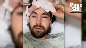 Jeff Wittek shows video from when he was in the hospital after near fatal  stunt