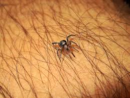 However, unlike the brown recluse spider bite, it does not cause local necrosis. Spider Bites What To Do If You Ve Been Attacked By A Spider Canberra Pest Control