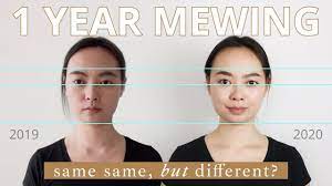 We did not find results for: 1 Year Mewing Before After Age 29 Youtube