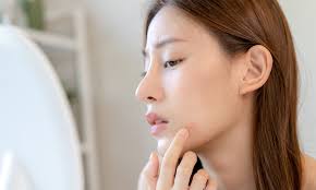 New remedies in treating adolescent acne are