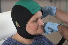 To prevent hair damage that may cause hair loss, follow these tips: Fda Expands Use Of Cooling Cap To Prevent Hair Loss From Chemo Medical Design And Outsourcing