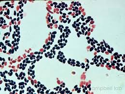 Yeast Gram Stain Google Search Candida Yeast Candida Symptoms Candida