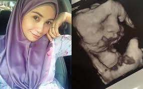 Pelakon izreen azminda dilihat hadir ke mahkamah syariah bersama suaminya. Https Gempak Com Berita Terkini Utamakan Masa Bersama Brad Pitt Tak Mahu Terlalu Mewahkan Anak Anak 19885 2019 05 31t13 39 41 000z Monthly 0 5 Https D3avoj45mekucs Cloudfront Net Astrogempak Media 3gadismanis Images Brad Pitt