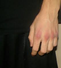 Home berita berita jatim ini penyebab warga ngawi meninggal dengan tangan berdarah. Prince Of Bad Boy Sudah Terbit Tujuh Belas Kembali Brutal Page 2 Wattpad