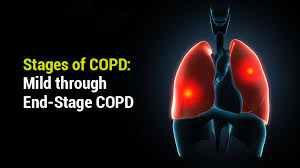 stages of copd mild through end stage copd lung institute