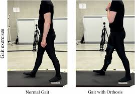 Image result for Gait