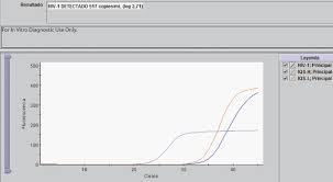 Pcr Cuantitativa Para La Deteccion De La Carga Viral De Vih Empireo