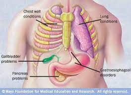 Chest pain can be caused by many diseases and condition, for example,angina, heart attack, shingles, pneumonia, pulmonary embolism, pericarditis, gerd while each cause of chest pain has classic symptoms and signs, there are enough variations in symptoms that it may take specific testing to. Common Causes Of Chest Pain Some Common Causes Of Chest Pain Include Download Scientific Diagram