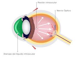 Image result for Intraocular Pressure