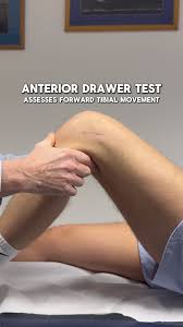 Image result for Pivot Shift Test
