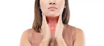 Image result for Goiter