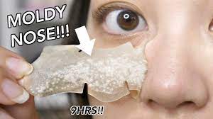 Remember—misuse can lead to inflammation, light bruising, or even broken capillaries (and, obviously, no one wants that). Congested Overnight Blackhead Strip My Pores Shrunk Dude Youtube
