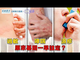 過敏 濕疹 哮喘 原來基因一早註定？ ｜ 日本命力呈獻: 健康關注組 ｜ EP526 ｜ 過敏體質 ｜ STAT6 ｜ 濕疹 ｜ 哮喘 ｜ 基因檢測 ｜ 敖嘉年 ｜ 麥詩敏 ｜ HOY TV 77台 | HOY 免費電視77台及78台 | LINE TODAY