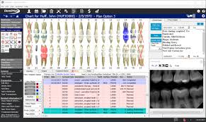 Software Dentimax 2019 Reseñas Precios Y Demos