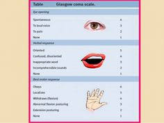 Glasgow coma scale is a neurological scale developed by teasdale and jennett and is also known as glasgow coma score. 24 Glasgow Coma 5 Comatose Ideas In 2021 Glasgow Coma Scale Glasgow Coma