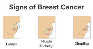 About 1 in 28 women are likely to develop breast cancer during their lifetime. Breast Cancer Ú¯Ø±ÙˆÙ‡ Ø®Ø³Ø±Ùˆ Ù…Ø¯ÛŒØ³Ø§ Ø·Ø¨