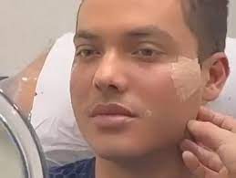 Check spelling or type a new query. Apos Harmonizacao Facial Wesley Safadao Foi Comparado Ao Ken Humano Veja Antes E Depois Popline