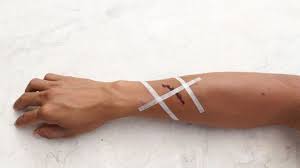How To Apply A Butterfly Bandage 11 Steps With Pictures They help you maintain stability and balance.