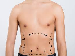 Check spelling or type a new query. Benefits Of Manual Lymphatic Drainage After Surgery