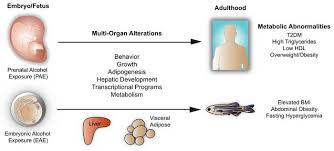 Jci Fetal Alcohol Spectrum Disorder Predisposes To Metabolic Abnormalities In Adulthood