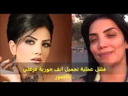 حورية فرغلي تدفع ثمن الصراحة؟ حورية فرغلي التي قالت رأيها صراحة في زملاءها علانية بتلك القسوة، بالطبع تكشف عن الحقيقة بينها وبين من تعرفهم والأمر يصل لهم وأيضا. ÙØ´Ù„ ØªØ¬Ù…ÙŠÙ„ Ø§Ù†Ù Ø­ÙˆØ±ÙŠÙ‡ ÙØ±ØºÙ„ÙŠ Horeya Farghaly Youtube