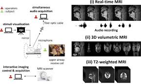 Like the english version, the dutch version was made up of sentences that . A Multispeaker Dataset Of Raw And Reconstructed Speech Production Real Time Mri Video And 3d Volumetric Images Scientific Data