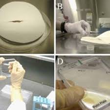 The doctors refusing to sterilise me have, without exception, been parents. Dry Sterilization And Planting For Dormant Plates A Sterilized Seeds Download Scientific Diagram